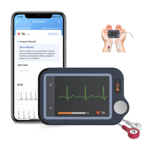 CheckMe Plus EKG-Gerät für Zuhause mit KI-Analyse und Echtzeitanzeige, kompaktes Handgerät mit grossem Display