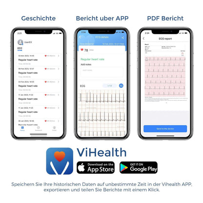 CheckMe Plus EKG Gerät – Bluetooth EKG Monitor für Zuhause