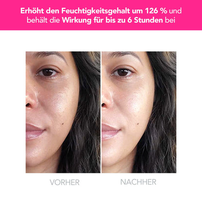 Foreo UFO 2 LED Gesichtsmaske – Rotlichttherapie