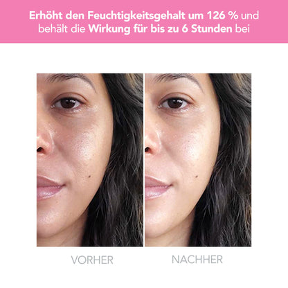Foreo UFO 2 LED Gesichtsmaske - Rotlichttherapie