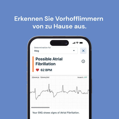 KardiaMobile EKG-Herzfrequenzmesser – 1-Kanal Version