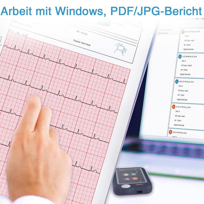 CheckMe Plus EKG Gerät – Bluetooth EKG Monitor für Zuhause