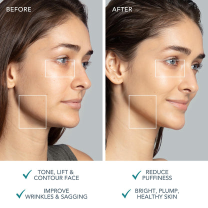 FOREO BEAR 2 Mikrostrom Gesichtsmassagegerät für Anti-Aging